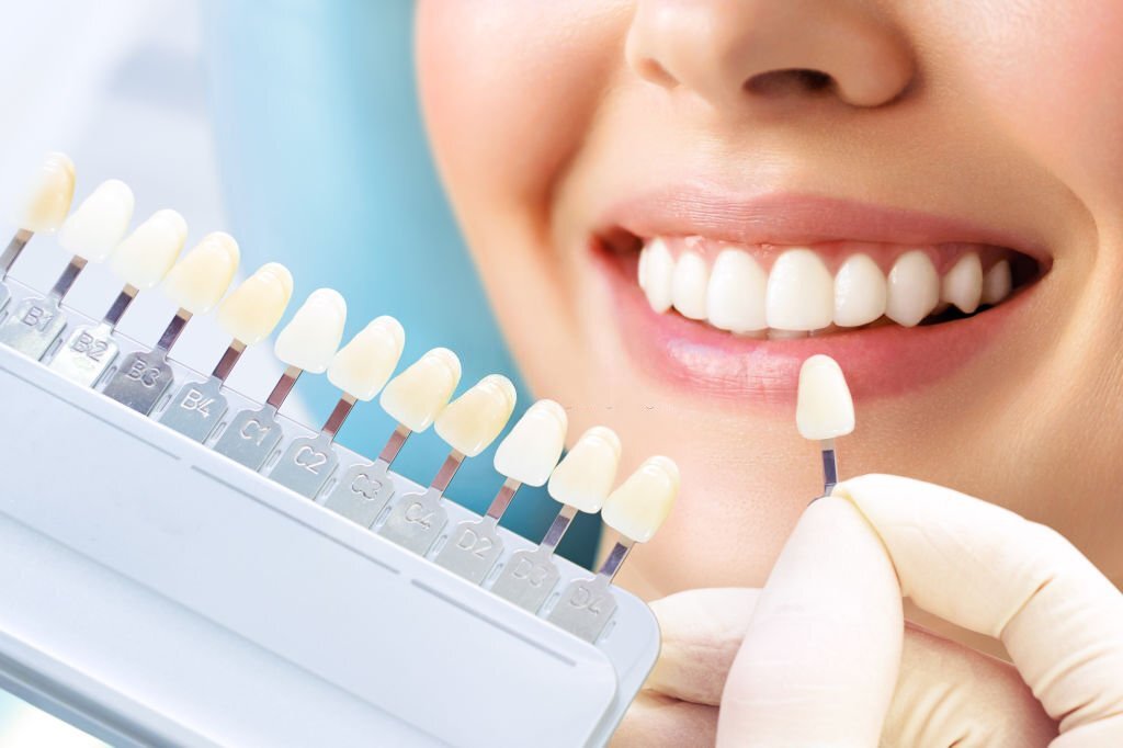 Dental Aesthetics in Fethiye Turkey