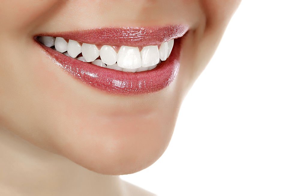Teeth whitening Fethiye
