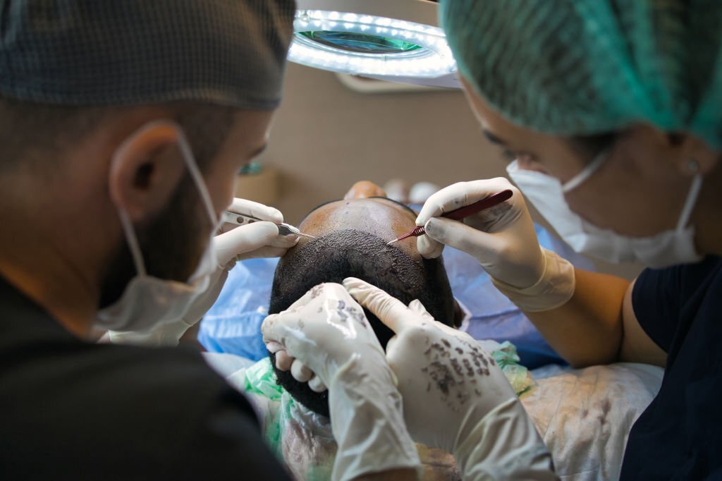 DHI Hair Transplantation in Fethiye